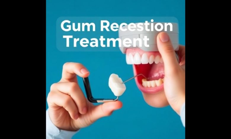 Gum Recession Treatment
